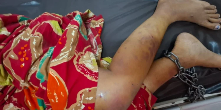 Suami di Jember Aniaya dan Merantai Kaki Istri yang Hamil Selama 4 Hari